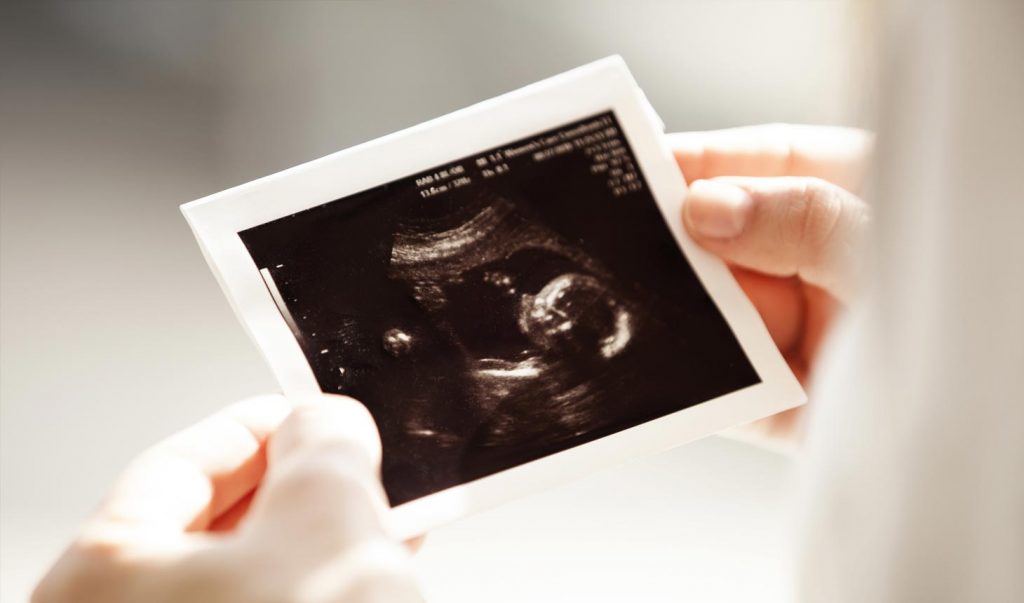 Toward a Principled Pro-Life Ethic in Post-Roe America