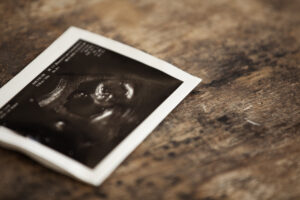 American Pastors and the End of Abortion